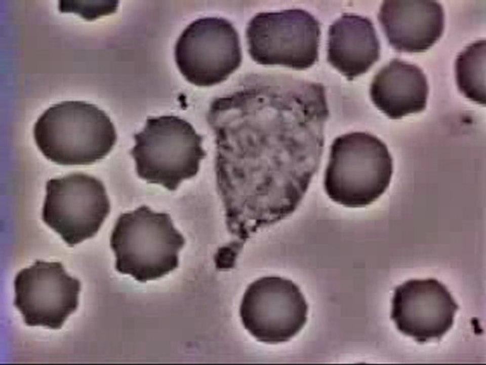 Akyuvar Bakteri Savaşı