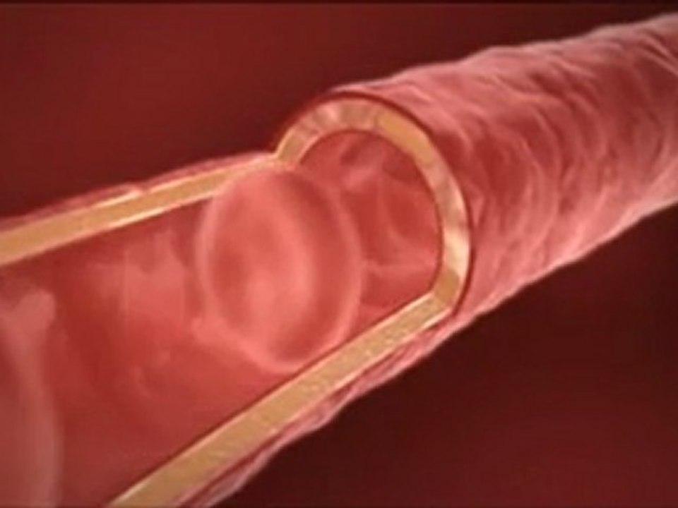 Aloe Vera Nettle - http://aloe-vera-infos.over-blog.com