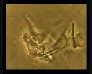 Walka organizmu czlowieka z bakteriami