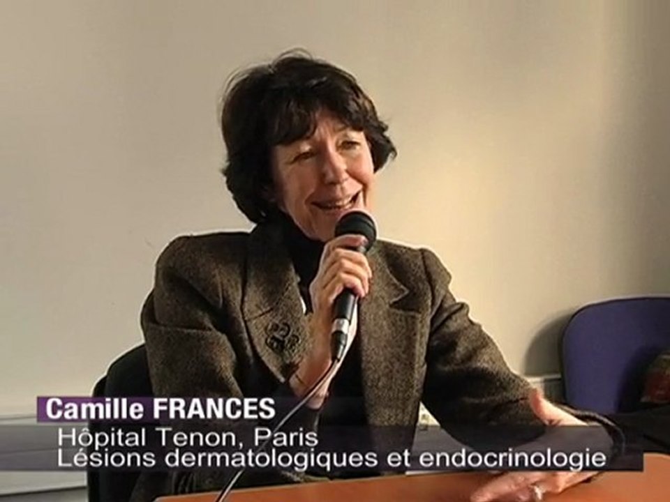 itw-c.frances