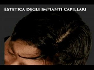 VISITA DEI CAPELLI www.luigiuomo.com