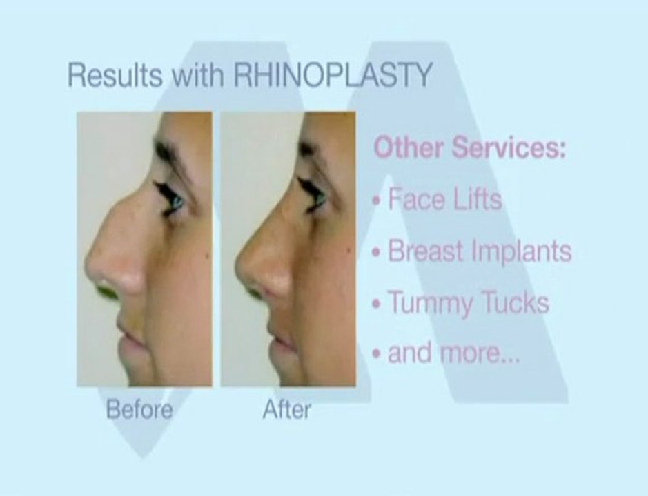 Haitham Masri for Laser and Cosmetic Surgery Plastic Surgery