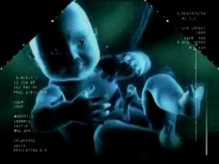 Daily motion Uploader