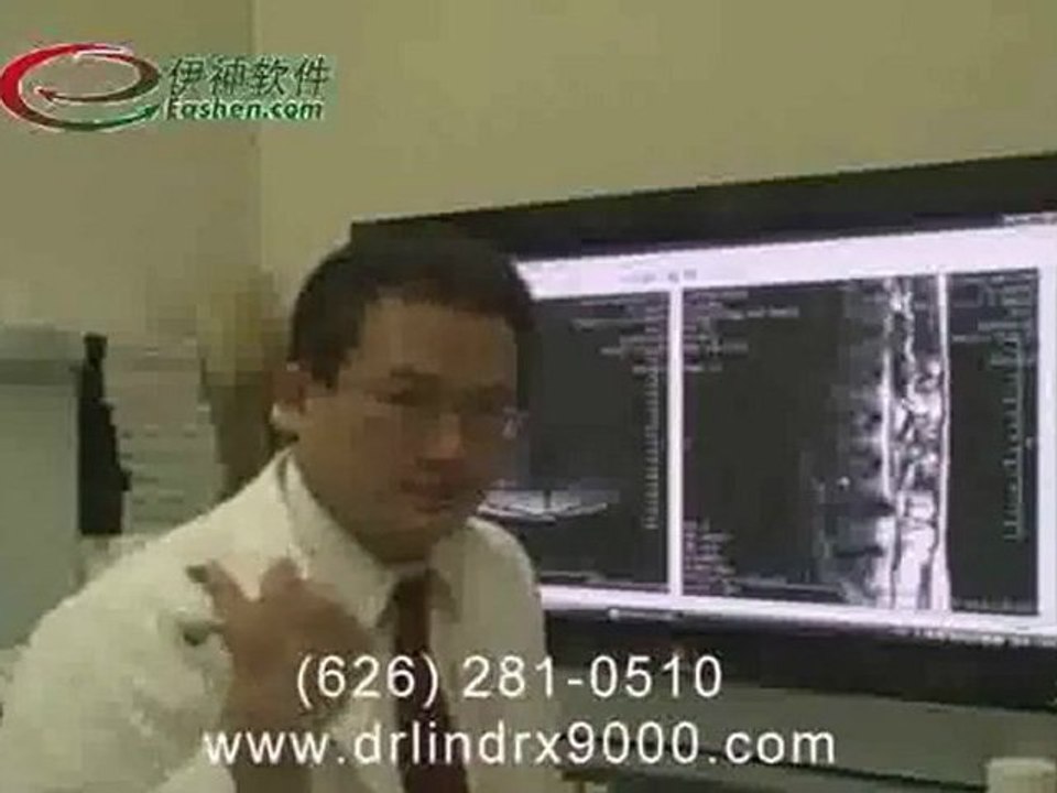 DRX 9000 Case Dtudy - Neck part 2