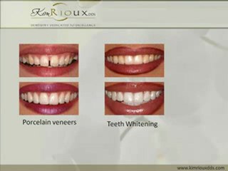 Port Orchard Washington (WA) Dentist Kim Rioux, DDS