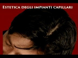 CENTRI CADUTA DEI CAPELLI www.luigiuomo.com