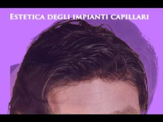 CENTRI PROTESI CAPILLARI www.luigiuomo.com