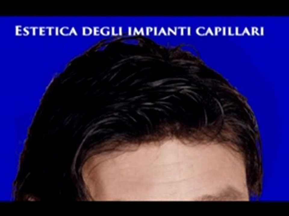 CENTRI PERDITA CAPELLI www.luigiuomo.com