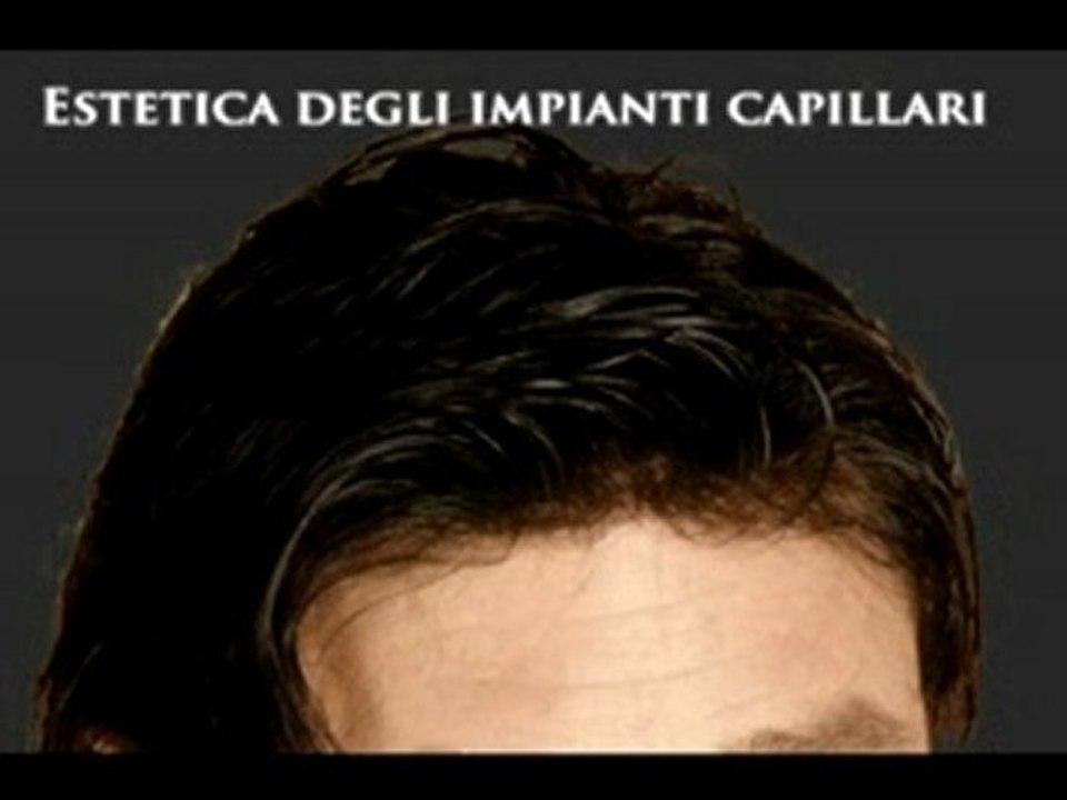 CENTRO TRAPIANTI CAPELLI www.luigiuomo.com