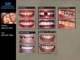 Cosmetic Dentistry by Powell Tennessee Dentist Dr. Ed ...