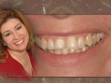 San Diego Emergency Dentist