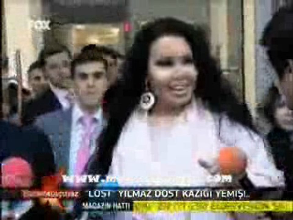 13-11-2010-FOX-BİZDEN KAÇMAZ-YILMAZ MORGÜL