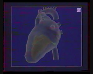 Automatyzm pracy serca