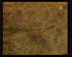 Miażdżyca, zawał, udar