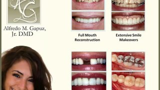 Cosmetic Dentistry by Lake Mary Florida Dentist Dr. ...