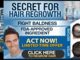 Provillus Hair Loss Remedy For Men