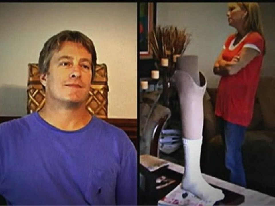 The Marriage Ref - Fake Leg