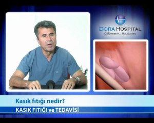 Kasık Fıtığı Nedir?