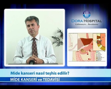 Mide Kanseri Nasıl Teşhis Edilir?