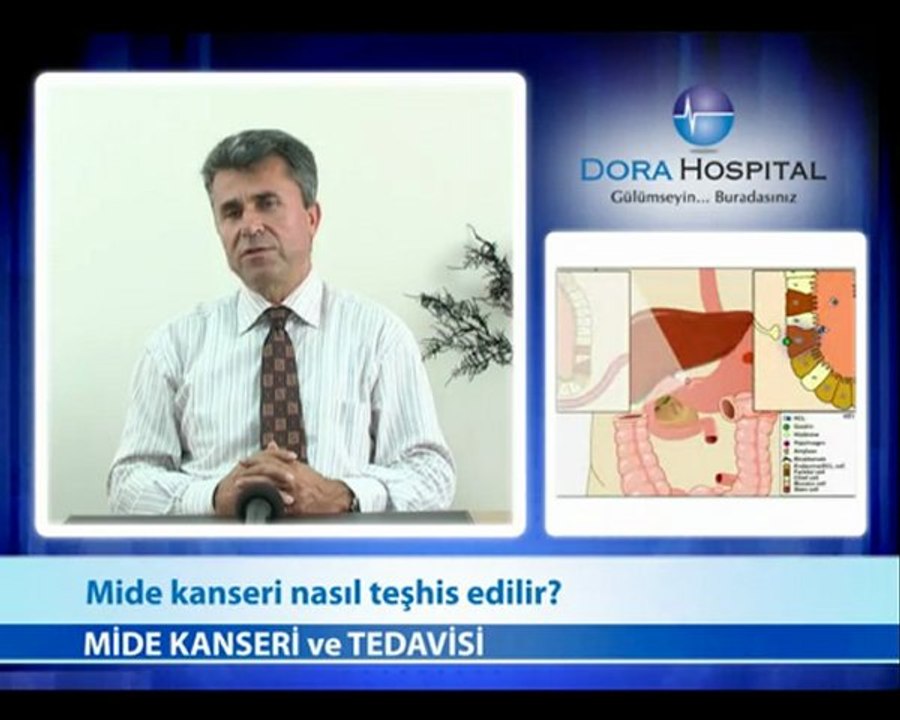 Mide Kanseri Nasıl Teşhis Edilir?
