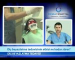 Diş Beyazlatma Tedavisinin Etkisi Ne Kadar Sürer?