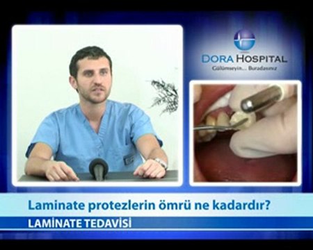 Laminate Protezlerin Ömrü Ne Kadardır?