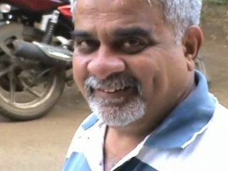 DEEPER DIMPLE CREATION IN INDIA IN ONE MINUTE BY DR VEREKAR