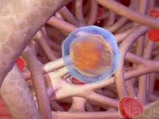 Quimioterapia (v.o. ingles)