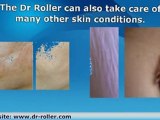 Dr Roller Dermaroller