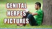 Treatment for genital herpes Symptoms Of Genital Herpes- Kno