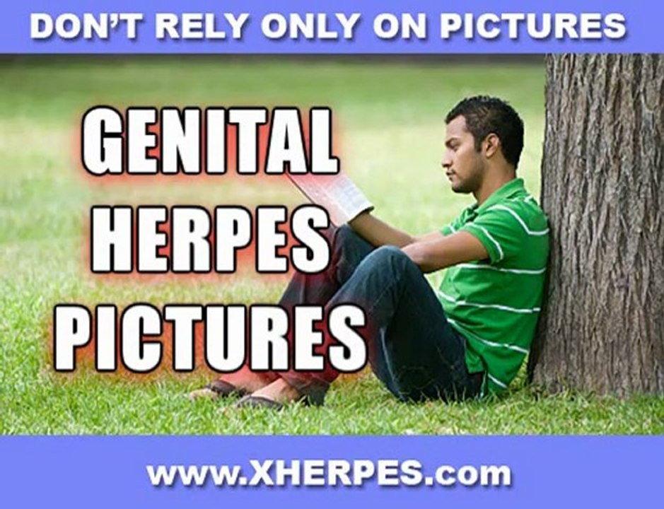Treatment for genital herpes Symptoms Of Genital Herpes- Kno