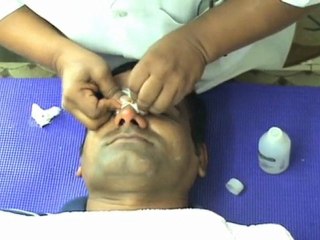 NOSE JOB & NOSE BEAUTIFICATION IN 3 MINUTES IN INDIA
