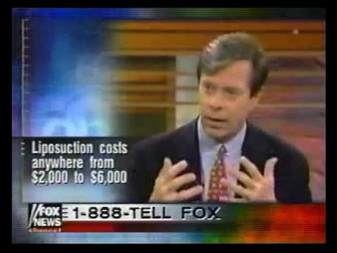 SMART LIPO MPX: SMART LIPO MPX SURGEONS