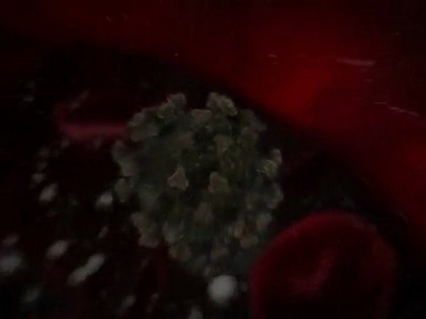 SIDA Vérité choquante AIDS HIV TRAILER