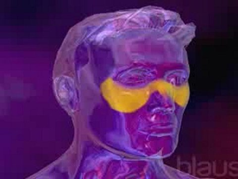 Lupus Eritematoso sistemico (v.o. ingles)