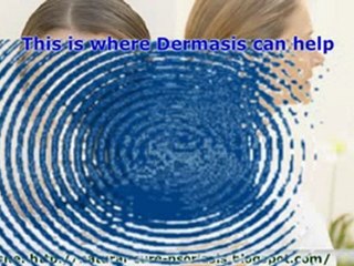 Dermasis Your Natural Cure For Psoriasis Get A Free Jar Toda