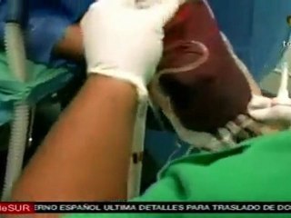 Misión médica, alivio para El Baúl