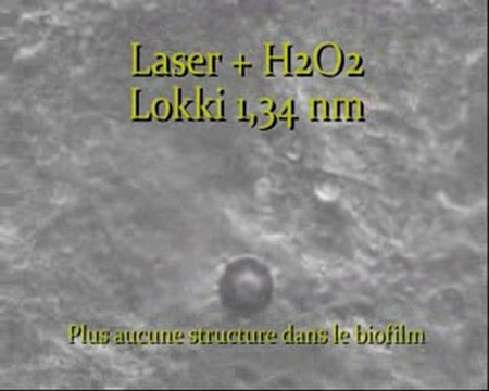 Biofilm dentaire amibes et action de différents produits