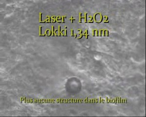 Biofilm dentaire amibes et action de différents produits