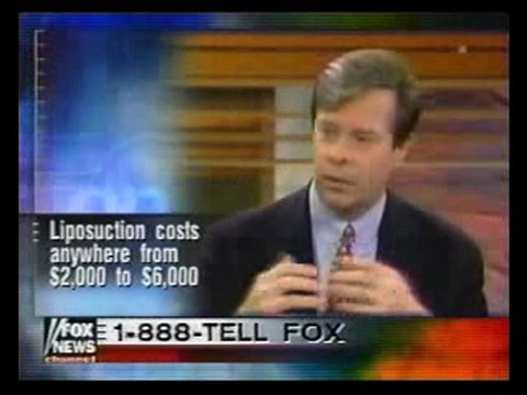 SMART LIPO MPX: SMART LIPO MPX SURGEONS