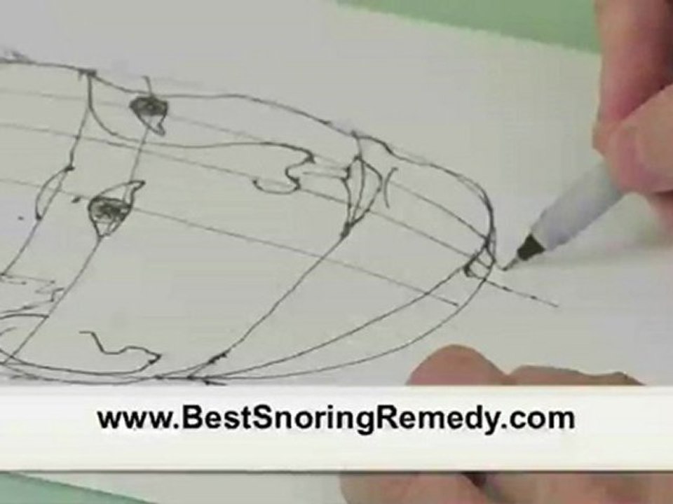 Snoring Cures Are Here!