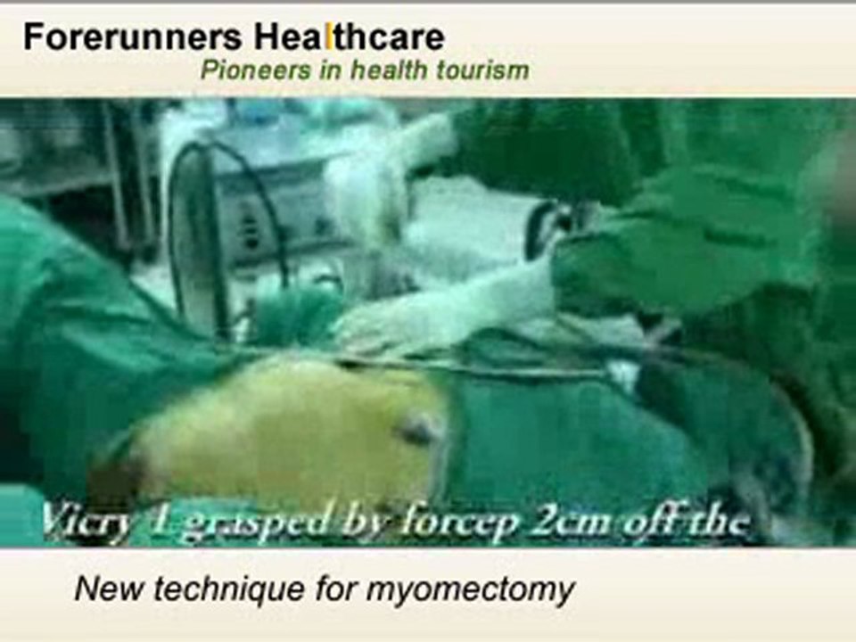 Get your Fibroid Tumor removed by highly experienced and bes