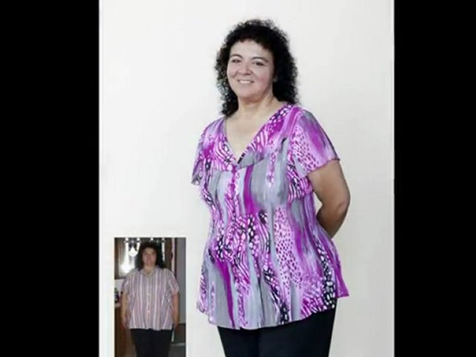 BMI of Texas San Antonio Bariatric Surgery Leaders