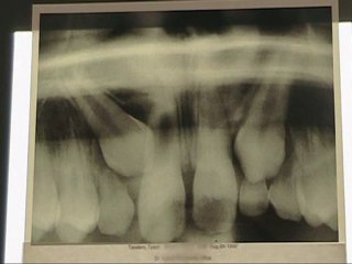 EDH Orthodontist Dr. Guess uses new free rewards program!