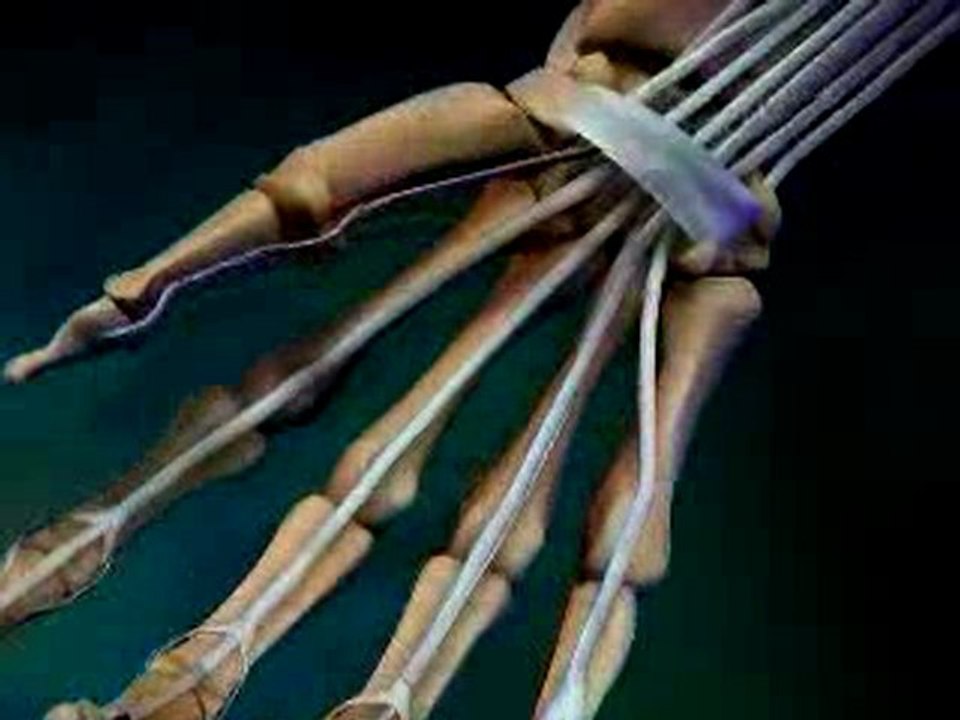 What is Carpal Tunnel Syndrome? - Chiropractor Atlanta Ga