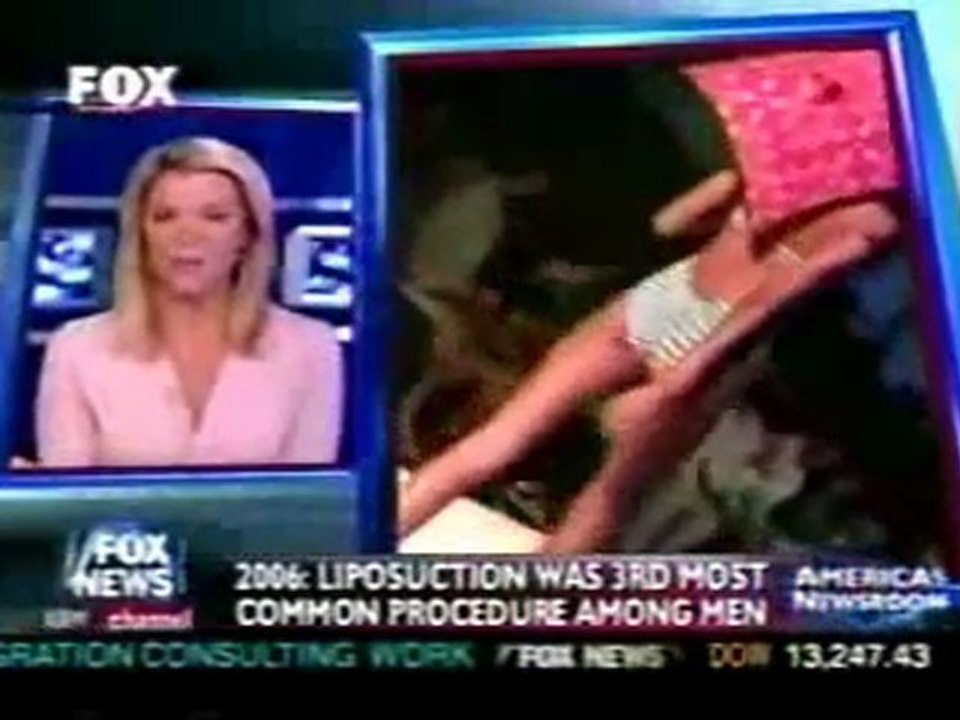 SmartLipo - Lee Canfield