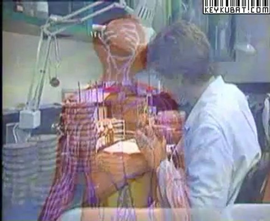 03X1 AIDS