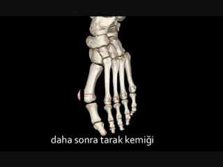 Halluks Valgus