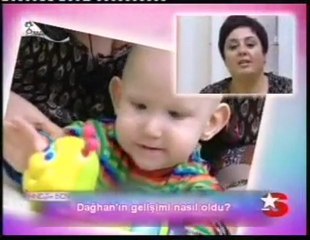 FG Sendromunda Bobath Terapi Yaklaşımı