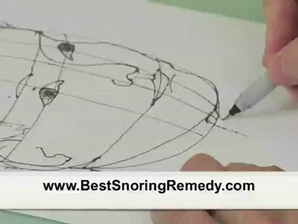 Buy Snoring Cures